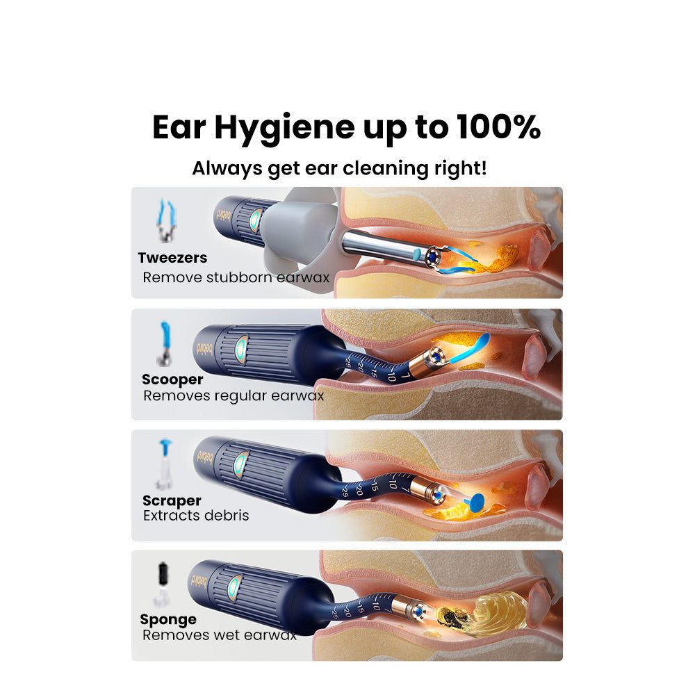 Olight OSelect Bebird Ear Sight Plus I35R Smart Ear Otoscope